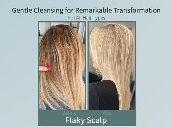 SH-RD Nutra-Therapy Conditioner (3.38oz/100ml)